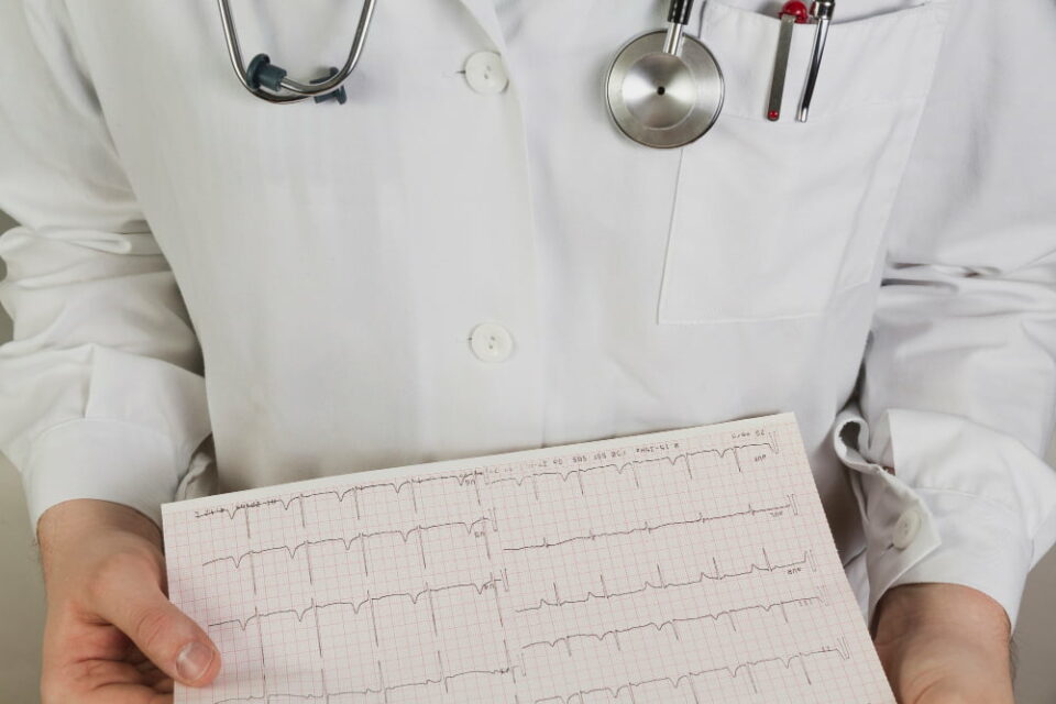 EKG Electrocardiograma