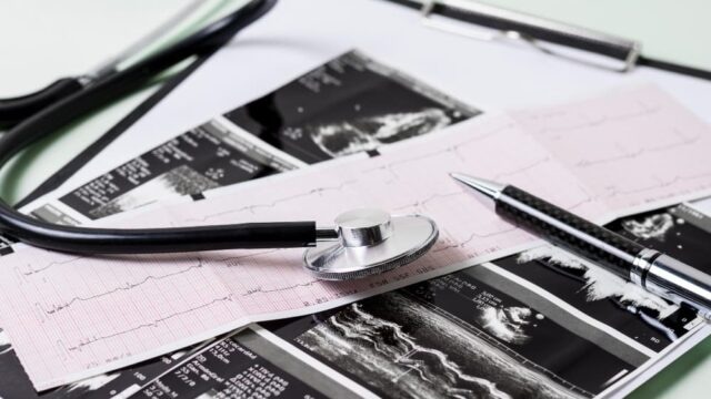 Ecografie cardiacă