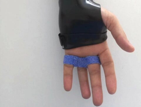 Orteze personalizate maini